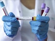 Poznati rezultati nalaza za osobe testirane sa područja Lukavca