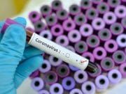 Još jedna osoba iz Lukavca zaražena koronavirusom